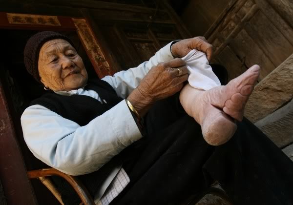 Китайские "лотосовые ножки" -"lily feet"- и ужасающие подробности этого обычая Китайские "лотосовые ножки" -"lily feet"- и ужасающие подробности этого обычая
