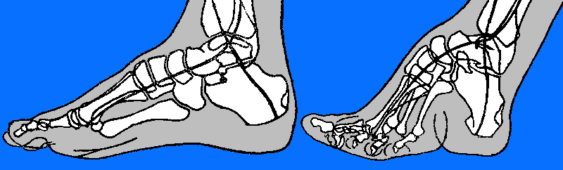 Китайские "лотосовые ножки" -"lily feet"- и ужасающие подробности этого обычая Китайские "лотосовые ножки" -"lily feet"- и ужасающие подробности этого обычая