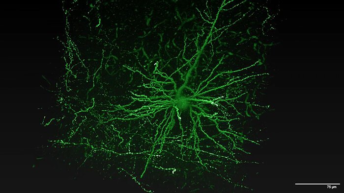 dendrites-axons-Mouselight