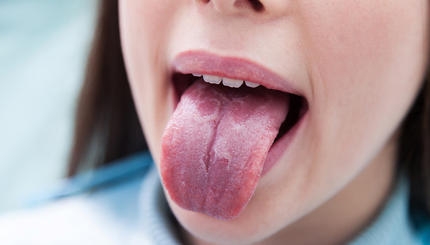 Россиянам назвали способ определить болезни по состоянию языка