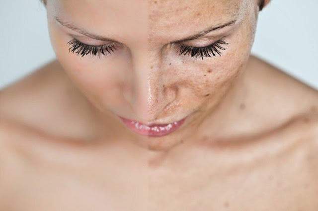 Применение масел для избавления от пигментных пятен на лице