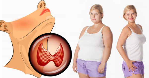 how-to-use-cbaethe-hypothyroid-methodcbae-to-fight-hypothyroidism-and-lose-weight-1