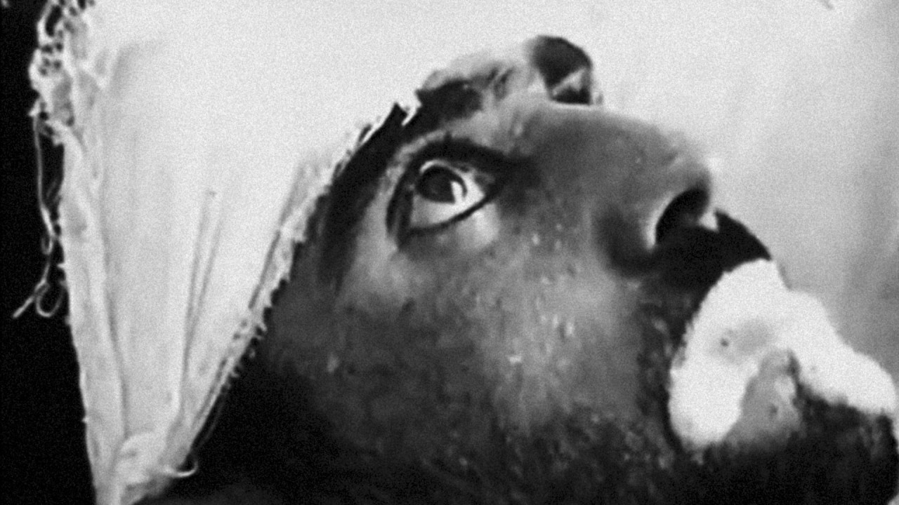«Если диагностируют бешенство». Самые страшные смерти людей за всю историю «Если диагностируют бешенство». Самые страшные смерти людей за всю историю