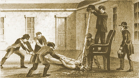 7 самых странных и невероятных медицинских процедур в истории