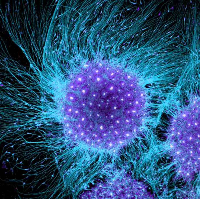 Снимки фотоконкурса «Nikon Small World 2016» (18 фото) Интересные микро снимки живой природы (18 фото)