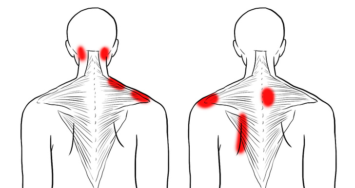 11 упражнений для снятия напряжения в шее и плечах