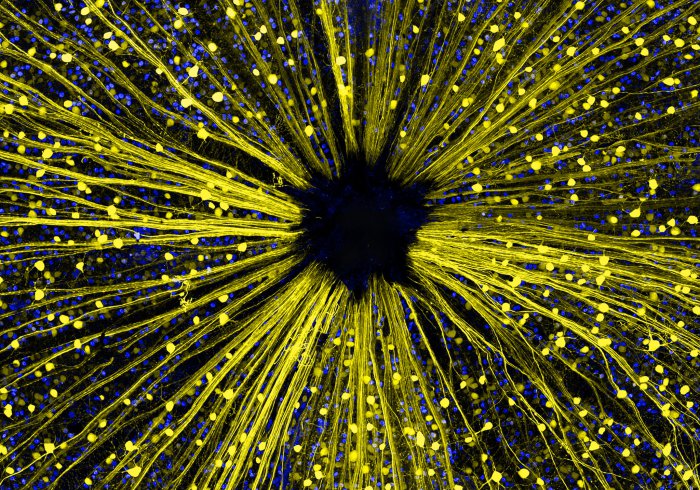 Снимки фотоконкурса «Nikon Small World 2016» (18 фото) Интересные микро снимки живой природы (18 фото)