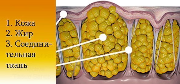 Целлюлит, как самый большой обман 21 столетия