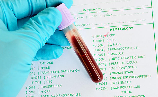 shutterstock_292786436-cbc-jarun-ontakrai-opener