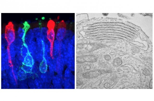 Фоторецепторы сетчатки, подкрашенные при помощи флуоресцирующих белков. Изображение: X. Zhong / C. Gutierrez / M.V. Canto-Soler / Wilmer Eye Institute / Johns Hopkins University School of Medicine
