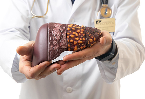 Metabolism: Популярный витамин оказался полезным при жировой болезни печени