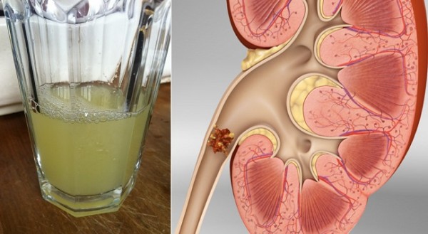 kidney-health-600x329