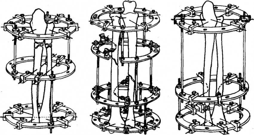 Russian inventions in human history, invention, Russia