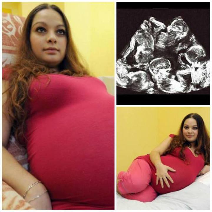 23-летняя Александра думала, что вынашивает близнецов, но, когда врачи показали ей результаты УЗИ, она расплакалась 23-летняя Александра думала, что вынашивает близнецов, но, когда врачи показали ей результаты УЗИ, она расплакалась