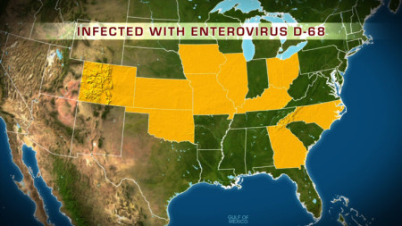 Enterovirus EV-D68 Spread