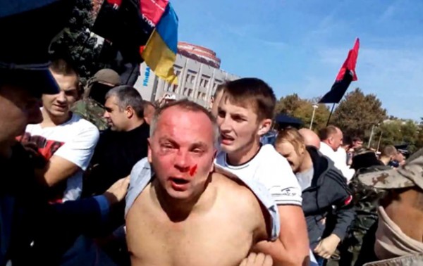 Борислав Береза: Шуфрич сам организовал свое избиение