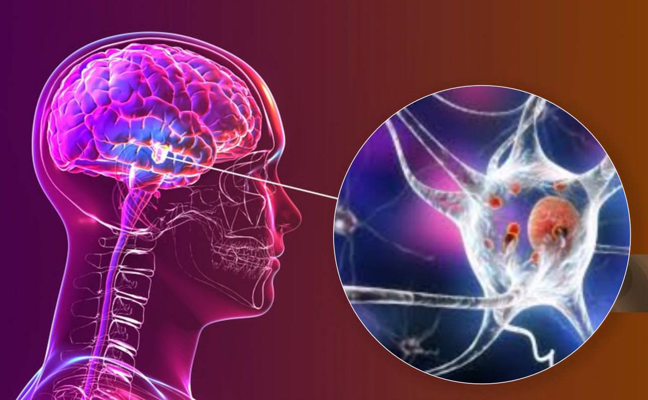 Новый метод выявляет болезнь Паркинсона по эмоциональным реакциям мозга