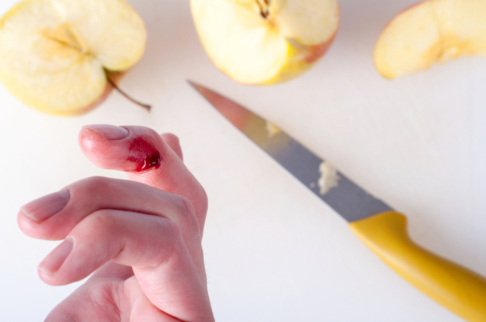 Резать продукты тупым ножом очень опасно. /Фото: healthprep.com Резать продукты тупым ножом очень опасно. /Фото: healthprep.com
