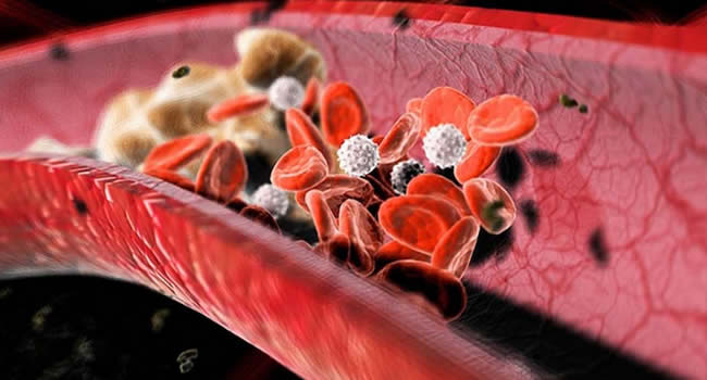 Народные средства. Снизить холестерин. cholesterol hight