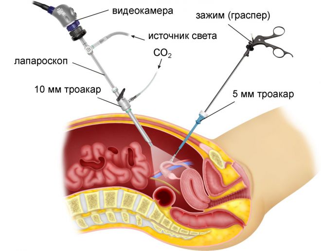 Операция