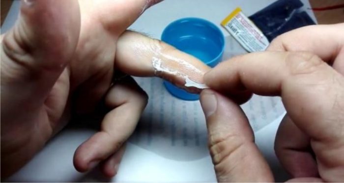 Как избавиться от суперклея, застывшего на пальцах