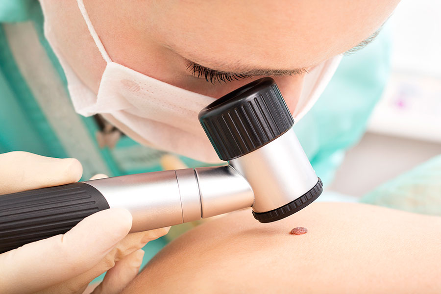 Что такое дерматоскопия и зачем её делают дерматоскопия,диагностика,здоровье,медицина,обследование