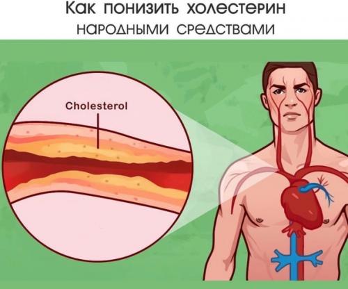 Как понизить холестерин народными средствами.