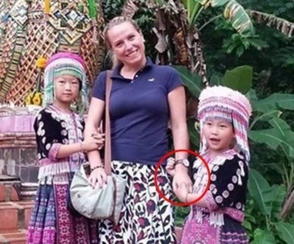 Коллекция бедолаг, которым не повезло в отпуске Коллекция бедолаг, которым не повезло в отпуске