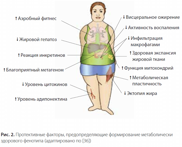 Здоровое ожирение и критерии