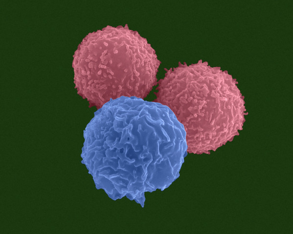Клетки-предшественники Т- и В-лейкоцитов. (Фото Dennis Kunkel Microscopy, Inc. / Visuals Unlimited / Corbis.)