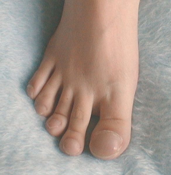 Следи за ногами. 10 признаков болезней, которые нельзя упустить болезни, здоровье