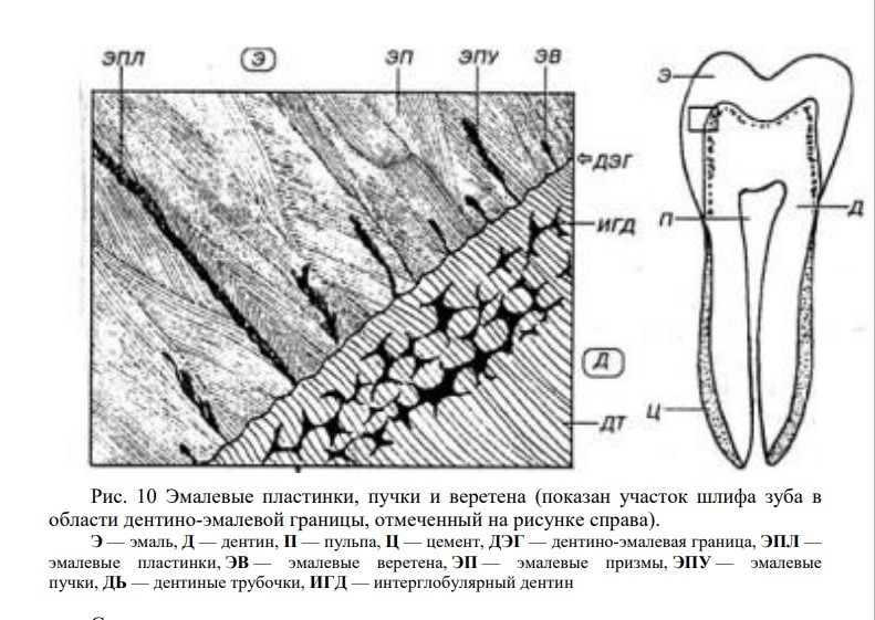 Флюороз — противоположность кариеса (и проверьте, что за воду вы пьёте)