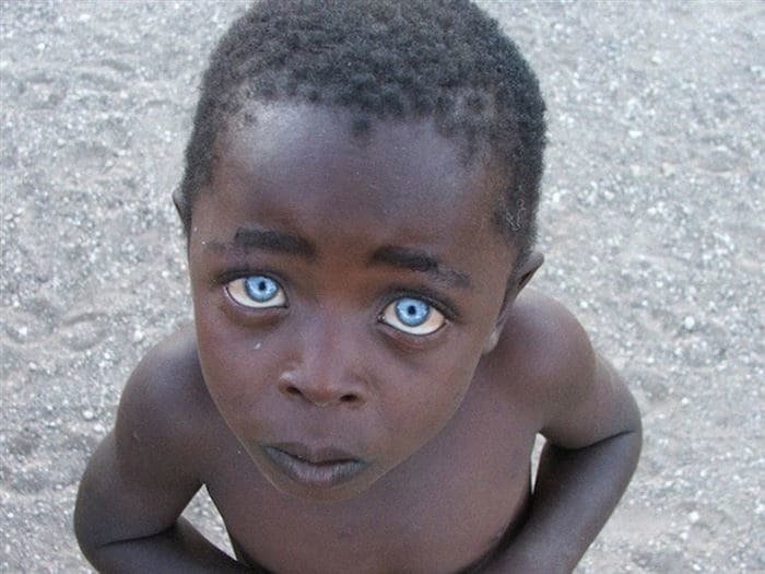 8. Невинность: африканский мальчик с невероятно редким цветом глаз в мире, интересное, исторические кадры, подборка, редкие фото, снимки, события, фото