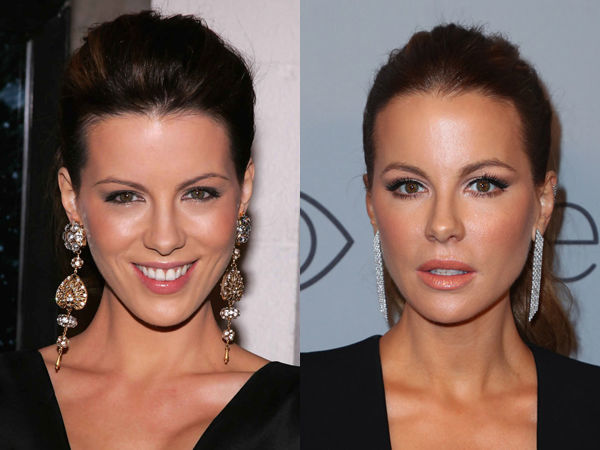 Подтяжка лица в 40 лет: удачные и неудачные звездные примеры знаменитости,красота,мода и красота