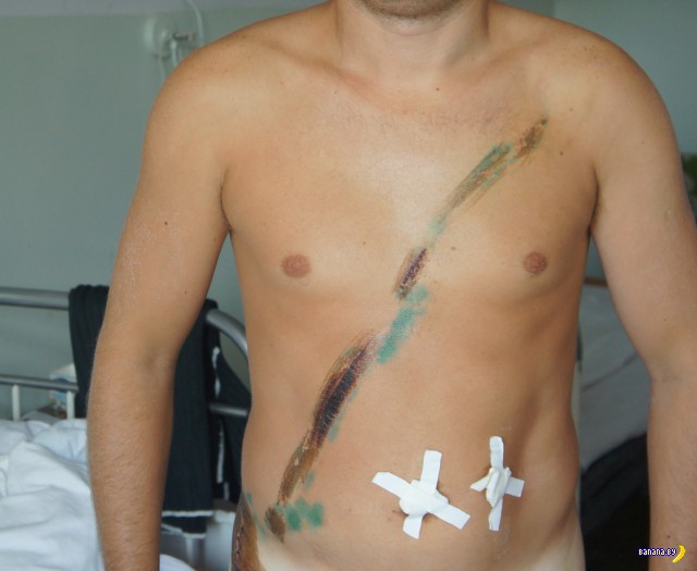 Наглядная реклама ремней безопасности дтп