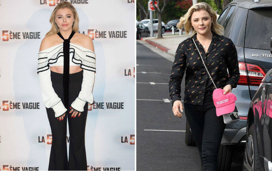 Знаменитости, которые недостатки внешности превратили в достоинства знаменитости