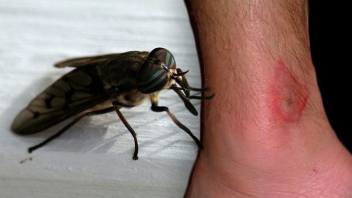 ТОП-10 фото, как выглядят укусы насекомых: клещи, мошки, клопы, осы, блохи и другие