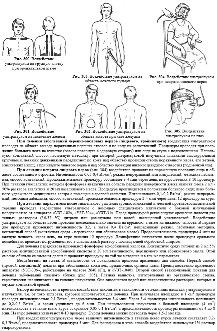 Схема ультразвуковая терапия