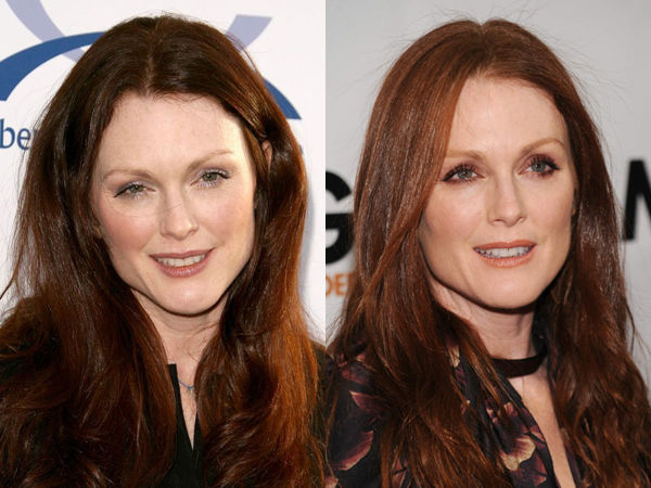 Подтяжка лица в 40 лет: удачные и неудачные звездные примеры знаменитости,красота,мода и красота