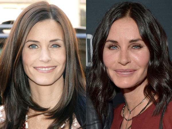 Подтяжка лица в 40 лет: удачные и неудачные звездные примеры знаменитости,красота,мода и красота