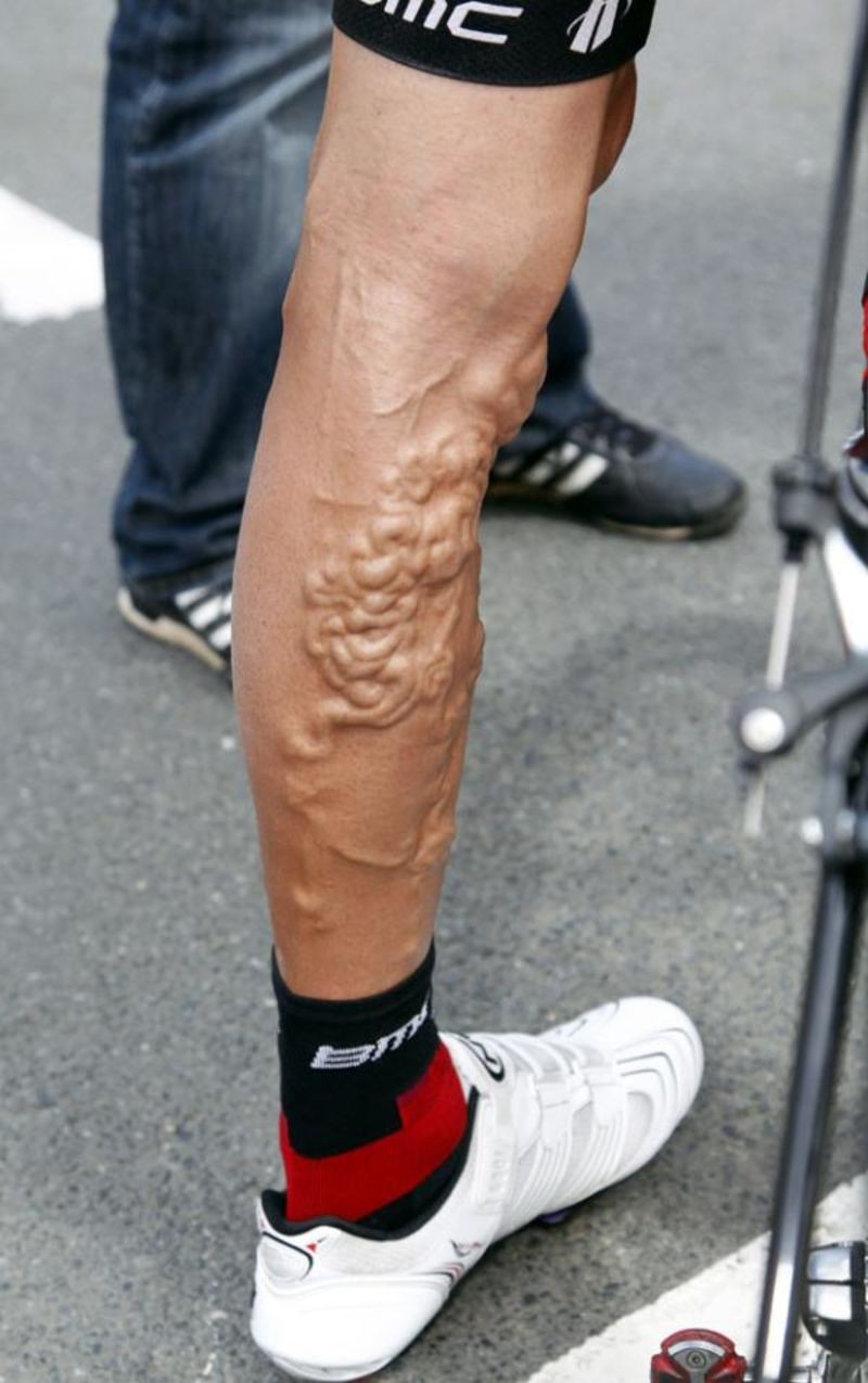 Велосипедисты шокируют видом своих ног! Этот пост лучше не смотреть тем, кто боится варикоза вены, ноги велосипедистов, спорт, фото