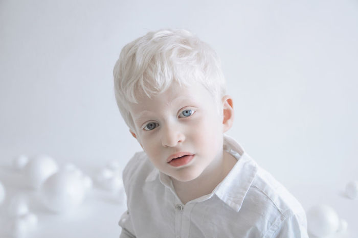 Фарфоровая красота: 13 фотографий «белоснежных» людей, которые кажутся очаровательными пришельцами Фарфоровая красота: 13 фотографий «белоснежных» людей, которые кажутся очаровательными пришельцами