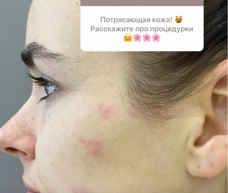 Ирена Понарошку выложила честное фото без макияжа