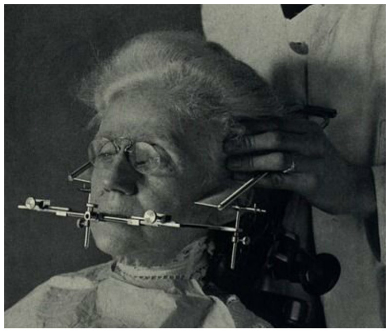 Зубная реконструкция, начало XX века интересное, прошлое, стоматологи, ужас, факты