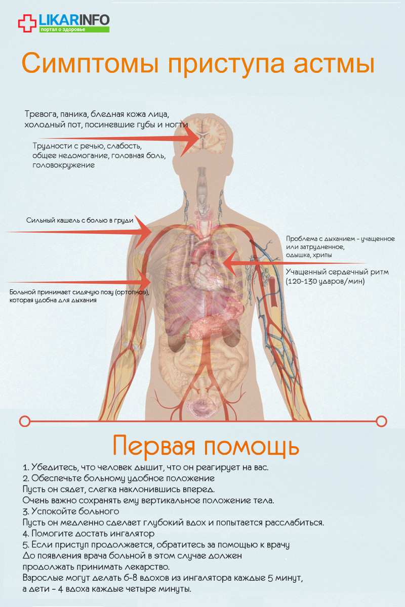 Приступ астмы. Что делать в домашних условиях? астма,болезни,здоровье,медицина,первая помощь,приступ астмы