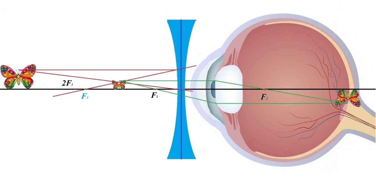 Какое изображение получается на сетчатке глаза человека увеличенное действительное