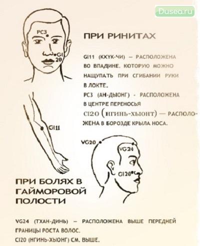 насморк