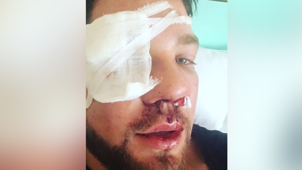 Эфир: Поможет ли ужесточение наказания за хулиганство остановить избиения на улицах