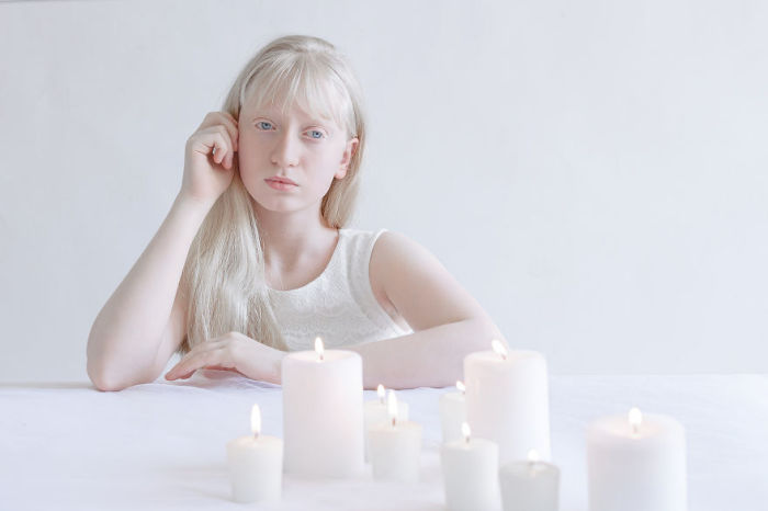 Фарфоровая красота: 13 фотографий «белоснежных» людей, которые кажутся очаровательными пришельцами Фарфоровая красота: 13 фотографий «белоснежных» людей, которые кажутся очаровательными пришельцами