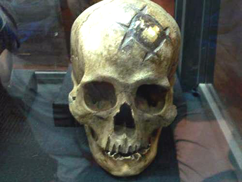 Инки – специалисты по трепанации черепа черепа, операции, инков, черепов, трепанации, трепанированных, такого, кости, одной, истории, чтобы, часто, после, черепе, производились, хирургической, трепанацию, применяли, Андах, Перуанских